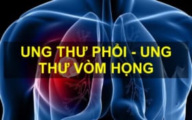 Diện Chẩn chăm sóc Ung thư phổi – vòm họng